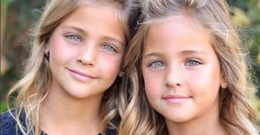 世界で最も美しい双子と称された彼女たち、その現在の姿をご覧ください